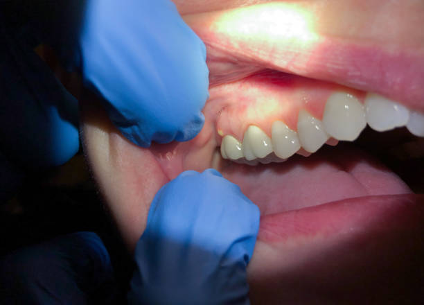 Best Pediatric Emergency Dentist in Clarion, PA